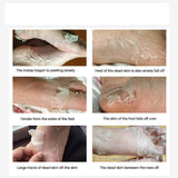 BABY FEET — FOOT PEEL MASK - B ANN'S BOUTIQUE