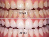 BEST WHITENING TOOTHPASTE ON THE MARKET - B ANN'S BOUTIQUE